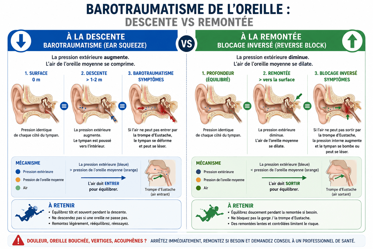 Comparaison des barotraumatismes en plongée